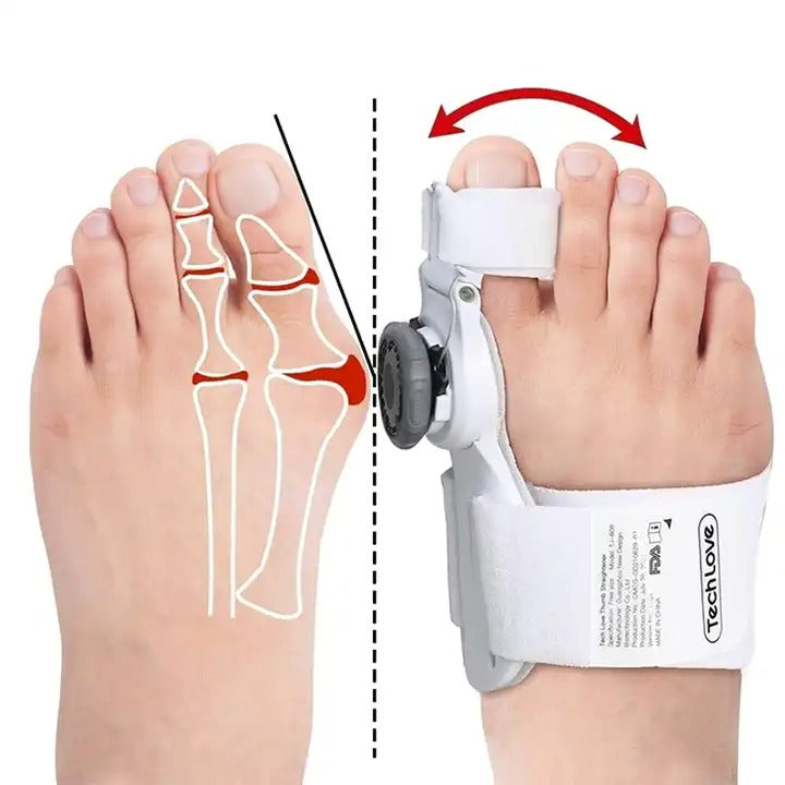 Advanced Bunion Corrector